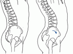 small-tilted-pelvis